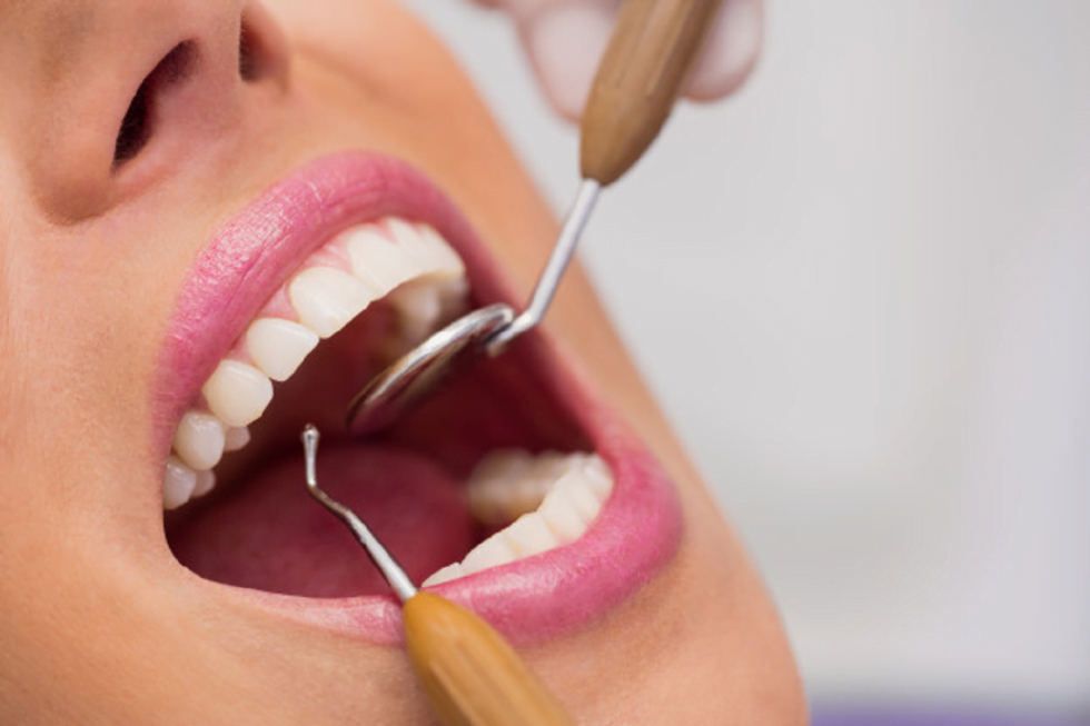 Know The Reasons You May Be Prone To Cavities Sarnia Dentist