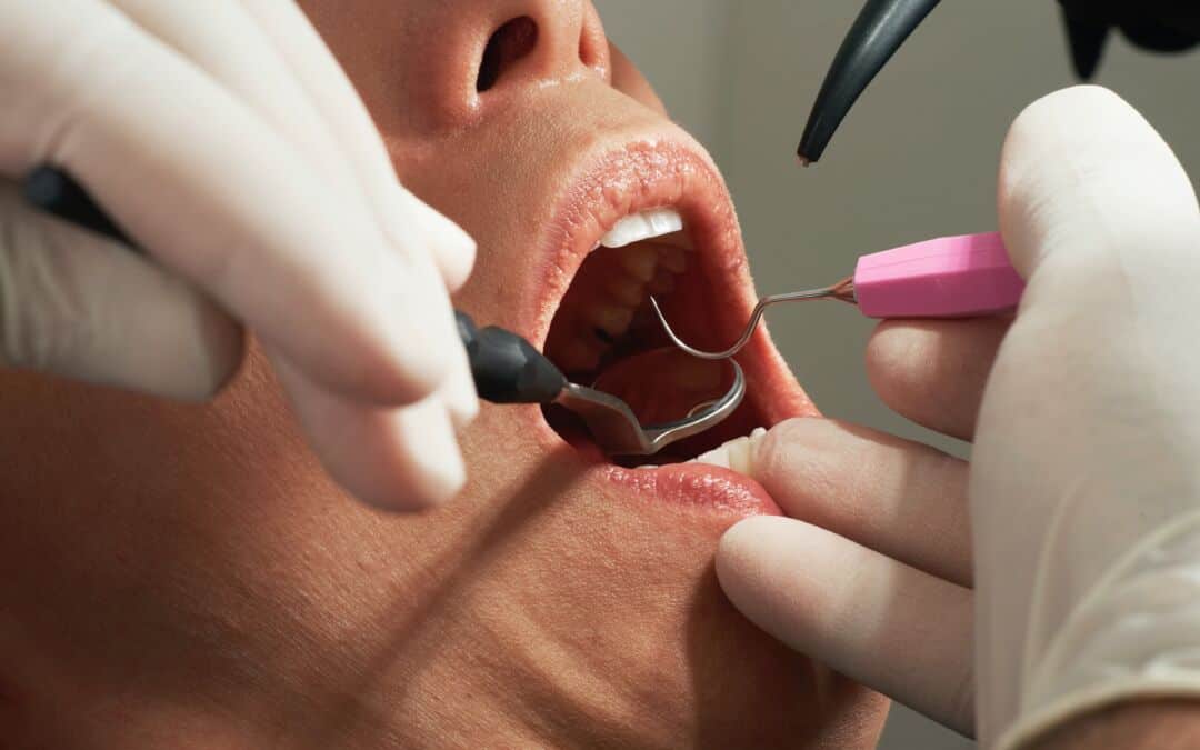 Tips for Taking Care of Your Dental Problems from a Professional Dentist