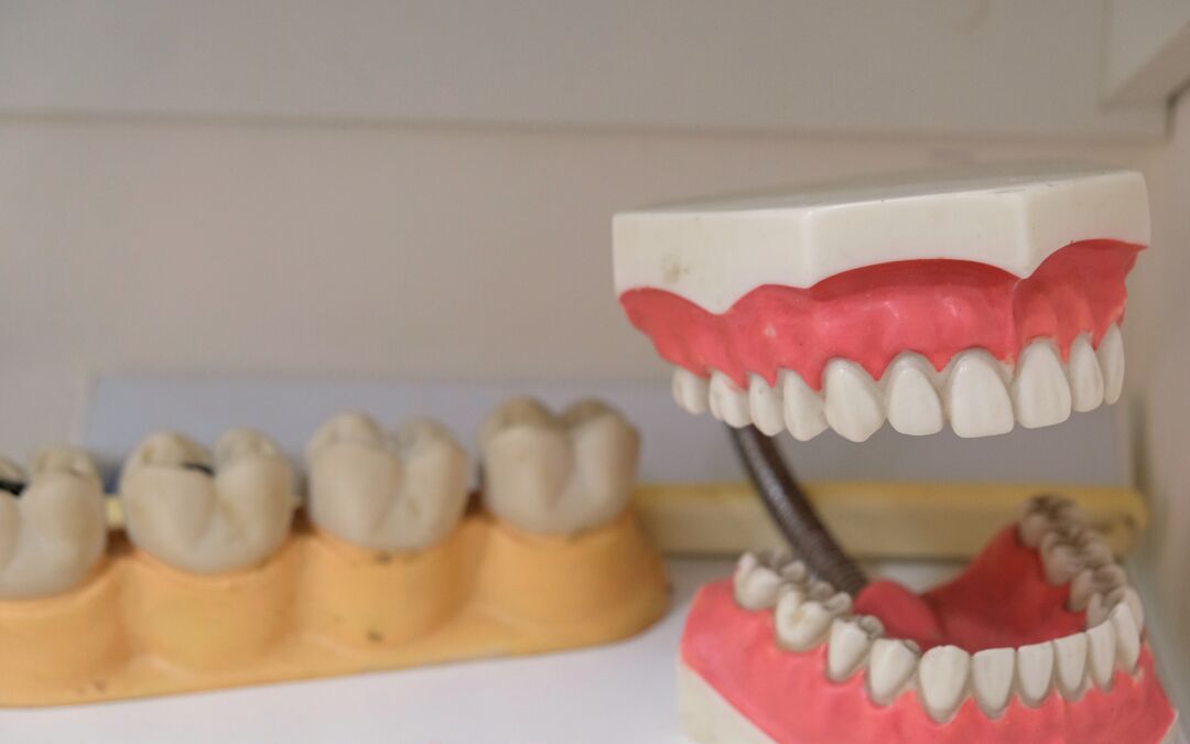 Tips To Prevent Jaw Bone Loss For Denture Wearers